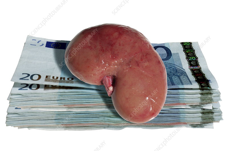 Kidneys For Sale Inside The Sprawling Underworld Of Human Organs