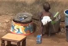 VIDEO: LAGOS RESCUES MALNOURISHED CHILD NEGLECTED OVER WITCHCRAFT CLAIMS