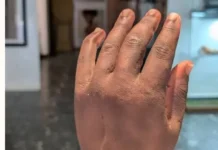 NIGERIAN INVENTOR’S BIONIC ARM NAMED AMONG TIME’S BEST INVENTIONS OF 2026